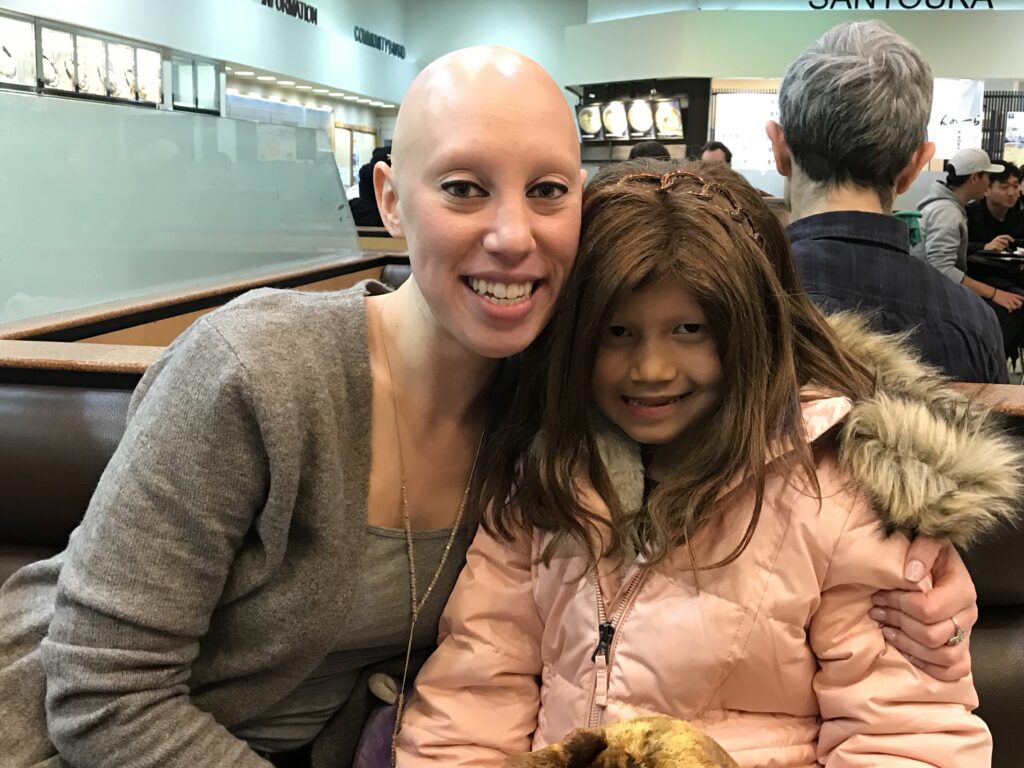 woman with alopecia areata and child