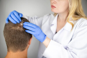 Dermatologist examining area of hair loss
