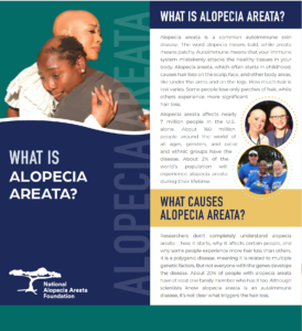 Whatis alopecia areata brochure